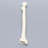 Radius, 5.5mm Canal, Foam Cortical Shell, Right