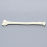 Radius, 5.5mm Canal, Foam Cortical Shell, Right