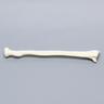 Radius, 5.5mm Canal, Foam Cortical Shell, Right