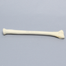 Radius with Three-Part Intra-articular Fracture, Foam Cortical