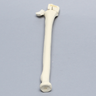 Radius with Distal Five-Part Intra-Articular Fracture, Foam Cortical