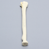 Radius with Transverse Fracture and Fragment, Foam Cortical