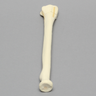 Radius with Transverse Fracture, Foam Cortical