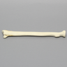 Radius with Transverse Fracture, Foam Cortical