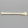 Radius with Transverse Fracture, Foam Cortical