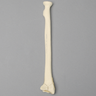 Radius with "Y" Fracture, Foam Cortical