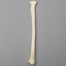 Radius with "Y" Fracture, Foam Cortical