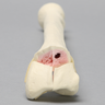 Radius with "Y" Fracture, Foam Cortical