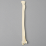 Radius with "Y" Fracture, Foam Cortical