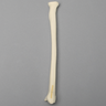 Radius with "Y" Fracture, Foam Cortical