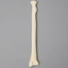 Radius with "Y" Fracture, Foam Cortical