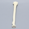 Radius, 5.5mm Canal, Foam Cortical, Left