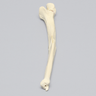 Ulna with Oblique and Transverse Fractures, Foam Cortical
