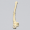 Ulna with Oblique and Transverse Fractures, Foam Cortical