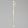 Ulna with Olecranon Fracture for Wire Tension Banding, Foam Cortical