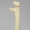 Ulna with Olecranon Fracture for Wire Tension Banding, Foam Cortical