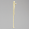 Ulna with Olecranon Fracture for Wire Tension Banding, Foam Cortical