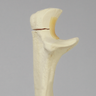 Ulna with Olecranon Fracture for Wire Tension Banding, Foam Cortical