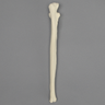 Ulna, 5mm Canal, Foam Cortical Shell, Right