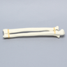 Ulna and Radius, Foam Cortical