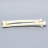 Ulna and Radius, Foam Cortical