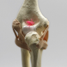 Arthroscopy Elbow Insert with Capsule and Cartilage