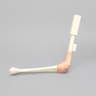 Arthroscopy Elbow Insert with Capsule and Cartilage