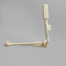 Arthroscopy Elbow Insert with Capsule and Cartilage