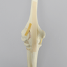 Elbow with Lateral Humeral Condyle Fracture, Foam Cortical