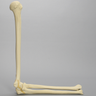 Elbow with Transverse Fracture, Foam Cortical