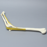 Elbow with Six-Part Fracture, Nerve, and Tendon, Foam Cortical