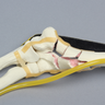 Elbow with Six-Part Fracture, Nerve, and Tendon, Foam Cortical