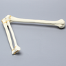 Elbow, Foam Cortical Shell, Right