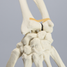 Hand and Wrist without Canal, Solid Foam
