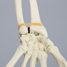 Hand and Wrist without Canal, Solid Foam