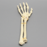 Hand and Wrist with Four-Part Fracture, Foam Cortical