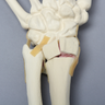 Hand and Wrist with Four-Part Fracture, Foam Cortical