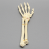 Hand and Wrist with Four-Part Fracture, Foam Cortical