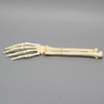 Hand and Wrist with Four-Part Fracture, Foam Cortical