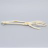 Hand and Wrist with Oblique and Colles' Fractures, Solid Foam