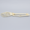 Hand and Wrist with Oblique and Colles' Fractures, Solid Foam