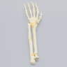 Hand and Wrist with Oblique and Colles' Fractures, Solid Foam
