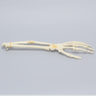 Hand and Wrist with Oblique and Colles' Fractures, Solid Foam