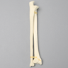 Ulna and Radius with Styloid Fracture, Foam Cortical