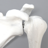 Intraosseous Access Shoulder Demonstrator