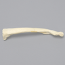 Clavicle with Transverse Fracture, Solid Foam