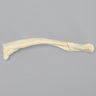Clavicle with Butterfly Fracture, Solid Foam