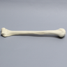 Humerus Unplugged, 9.5mm Canal, Solid Foam