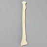 Radius with Oblique Fracture, Solid Foam
