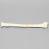 Radius with Long Oblique Fracture, 6.4mm Canal, Solid Foam